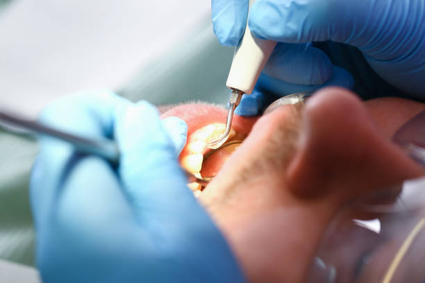 Best Root Canal Emergency Dentist  in Houston, MO
