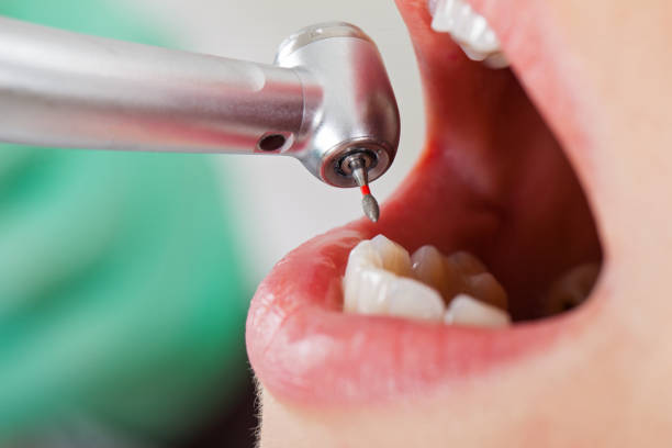 Best Broken Tooth Emergency  in Houston, MO